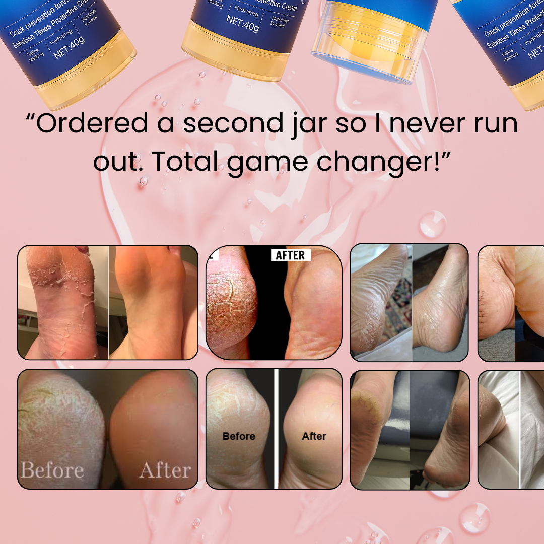Cracked heel repair & restoring cream