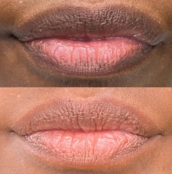 Dark Lip Brightening Cream