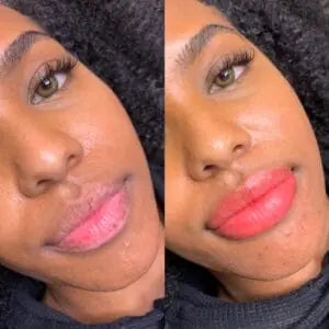 Dark Lip Brightening Cream