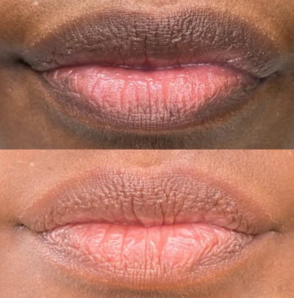 Dark Lip Brightening Cream