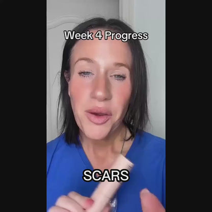 Silicone Wrinkle Stick